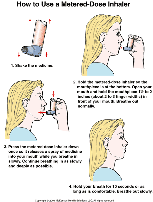 How to Use a Metered-Dose Inhaler: Illustration