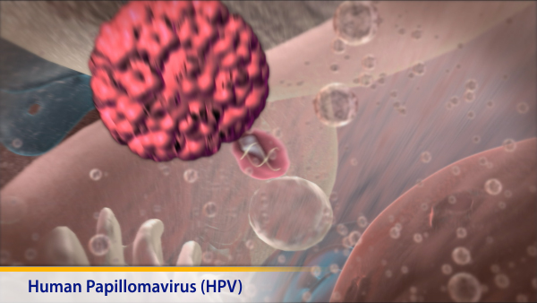 Thumbnail image of: Human Papillomavirus (HPV)