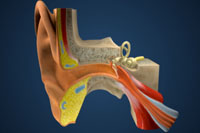 Thumbnail image of: Hearing Loss