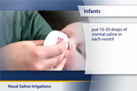 Thumbnail image of: Nasal Saline Irrigations (pediatric)