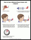Thumbnail image of: Metered-Dose Inhaler, How to Use with a Spacer: Illustration