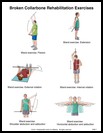 Thumbnail image of: Broken Collarbone Exercises, Page 1: Illustration