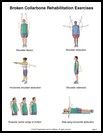 Thumbnail image of: Broken Collarbone Exercises, Page 2: Illustration