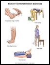 Thumbnail image of: Broken Toe Exercises: Illustration