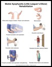 Thumbnail image of: Little Leaguer's Elbow Exercises: Illustration