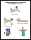Thumbnail image of: Tennis Elbow Exercises, Page 2: Illustration