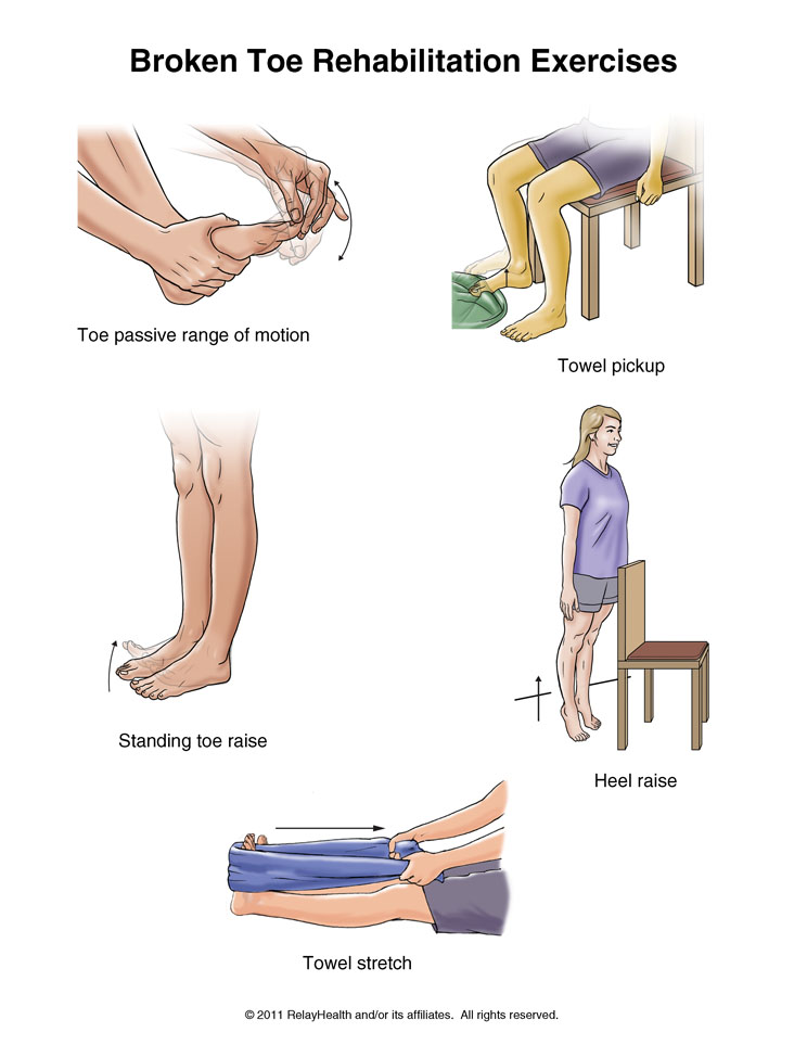 Broken Toe Exercises: Illustration