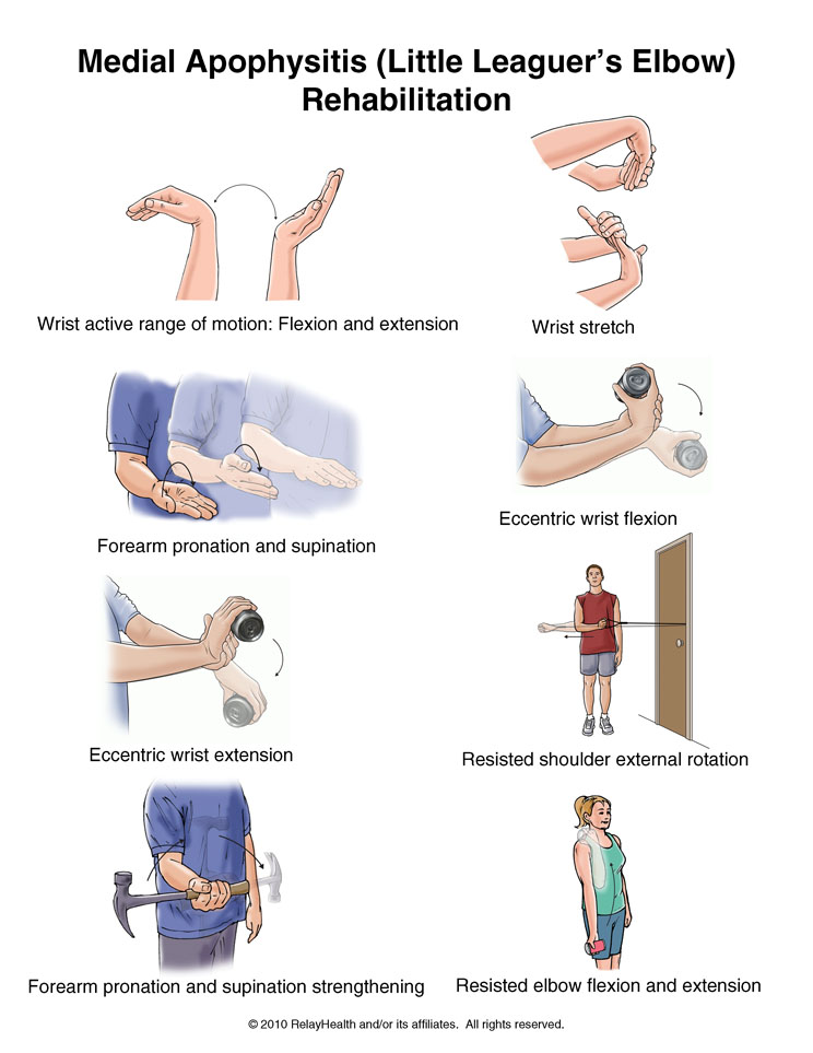 Little Leaguer's Elbow Exercises: Illustration
