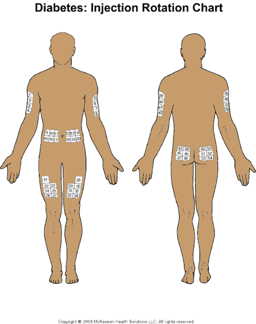 Diabetes: Injection Rotation Chart