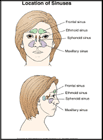 Thumbnail image of: Ubicacin de los senos nasales: ilustracin
